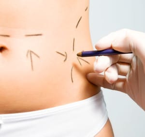 Plastische Chirurgie