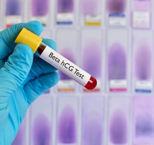 HCG Test
